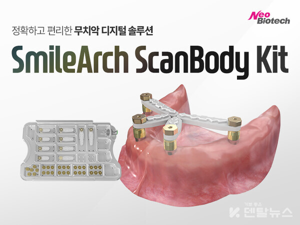 네오바이오텍이 무치악 환자를 위한 SmileArch ScanBody Kit를 출시했다. 덴탈뉴스