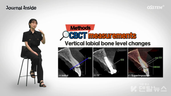 조영단 교수의 저널인사이드/임플란트즉시 식립 시 골이식 여부가 골 차원 변화에 미치는 영향.덴탈뉴스
