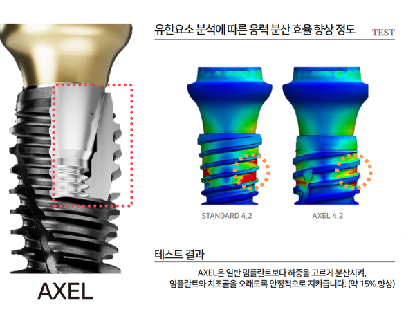 AXEL은 즉시식립에 최적화된 디자인과 함께, 상단부의 기계공학적 구조 개선으로 내구성을 크게 높인 제품이다. 덴탈뉴스
